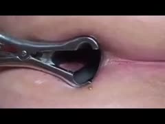 Stretching my girlfriend's constricted anus with metal speculum